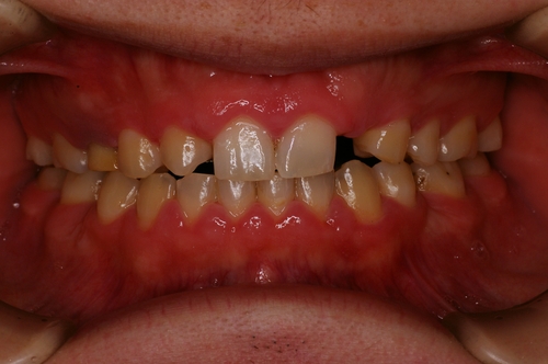 niigata_ whitening_ok3.jpg